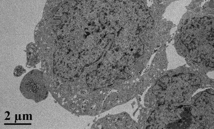 UHPLC chromatogram showing >95% Terrein purity